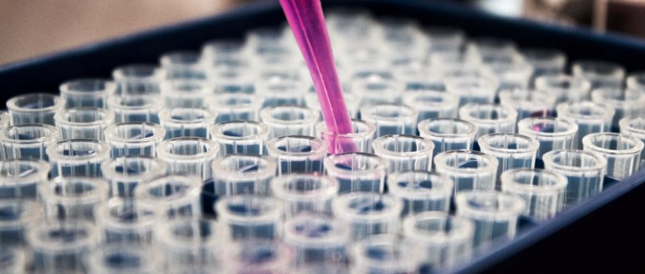 Reagenzgläser mit Pipette